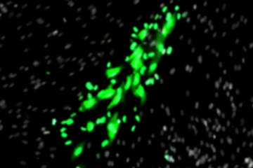 As part of Dr. Xi’s research, cells are infected by cytomegalovirus, shown in green florescence under a microscope.