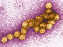 A digitally colorized transmission electron microscopic image of the West Nile virus. (Image: CDC/P.E. Rollin, Cynthia Goldsmith)
