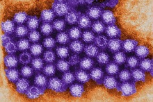 Just 10 particles of norovirus, the highly infectious microbe that causes food poisoning, can cause illness in humans. (Photo: Charles D. Humphrey/CDC)
